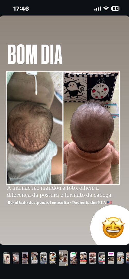 Resultado de paciente dos EUA - 1 consulta