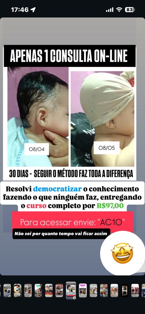 Resultado de apenas 1 consulta online - 30 dias